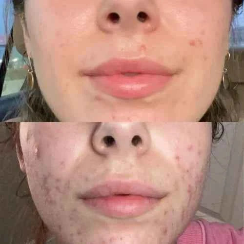 7-Color LED Facial Rejuvenation Mask