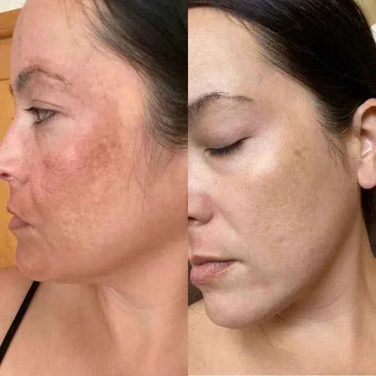 7-Color LED Facial Rejuvenation Mask
