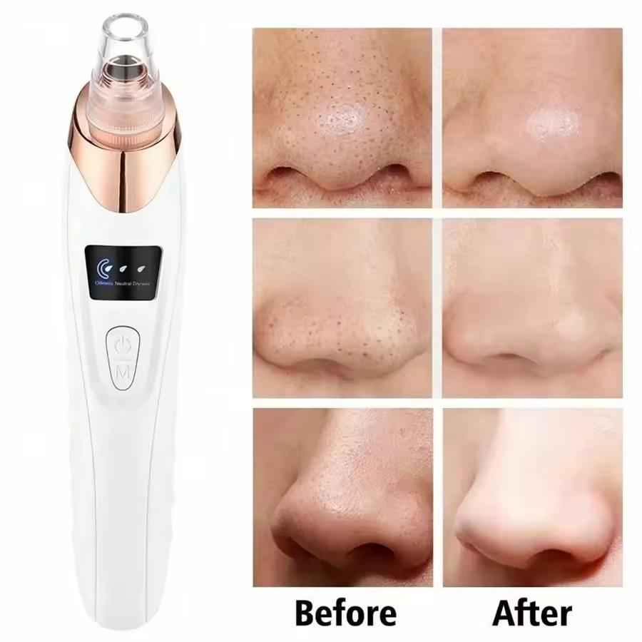 Blackhead Remover Pore Vacuum – Deep Cleansing Facial Suction Device