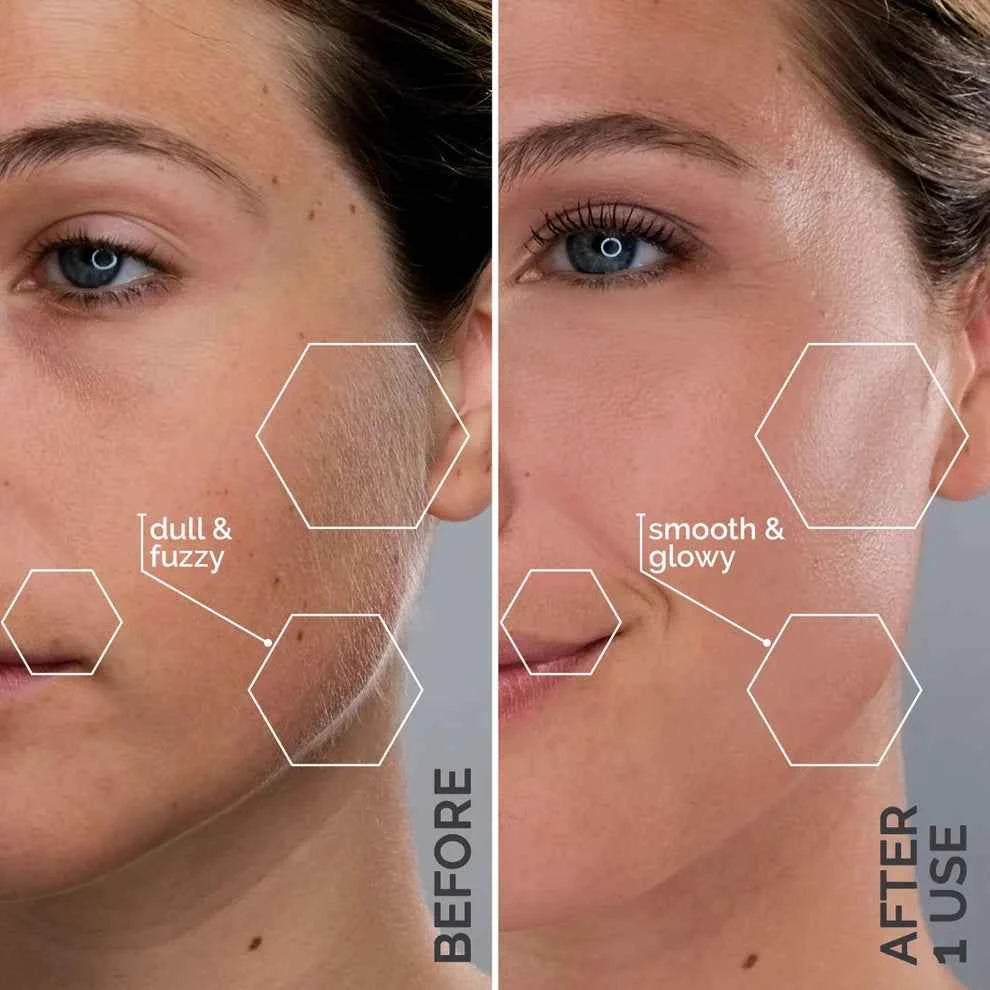 Rechargeable Painless Facial Hair Remover with LED Light & 16 Refill Heads