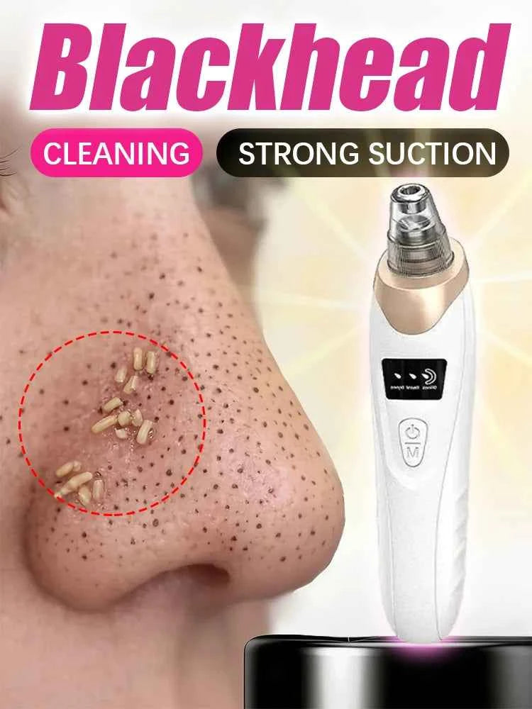Blackhead Remover Pore Vacuum – Deep Cleansing Facial Suction Device