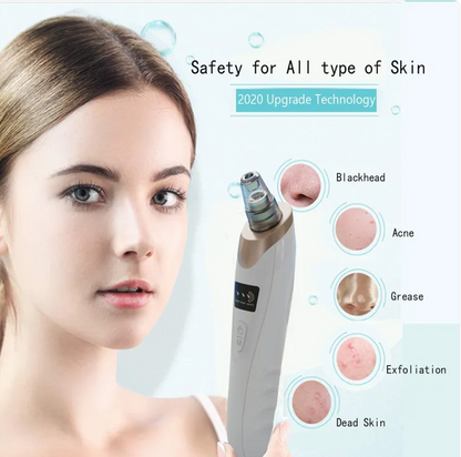 Blackhead Remover Pore Vacuum – Deep Cleansing Facial Suction Device