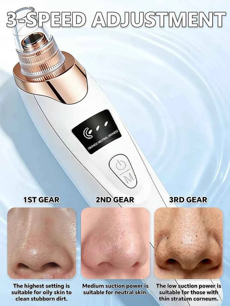 Blackhead Remover Pore Vacuum – Deep Cleansing Facial Suction Device
