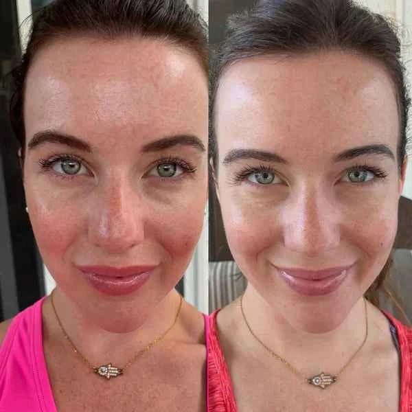 7-Color LED Facial Rejuvenation Mask
