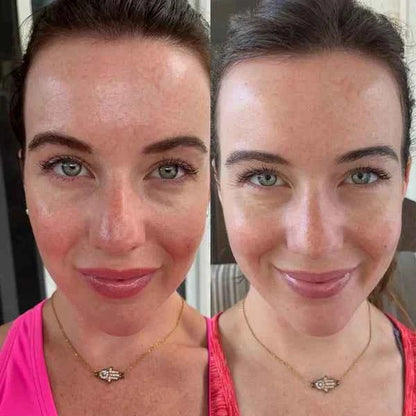 7-Color LED Facial Rejuvenation Mask