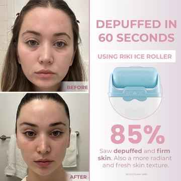 Ice Roller Facial Massage Set – Cooling Gua Sha Skincare Tool