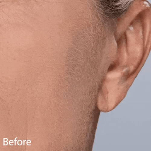 Rechargeable Painless Facial Hair Remover with LED Light & 16 Refill Heads - Cleoura