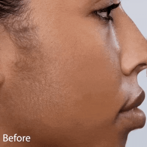 Rechargeable Painless Facial Hair Remover - packaging